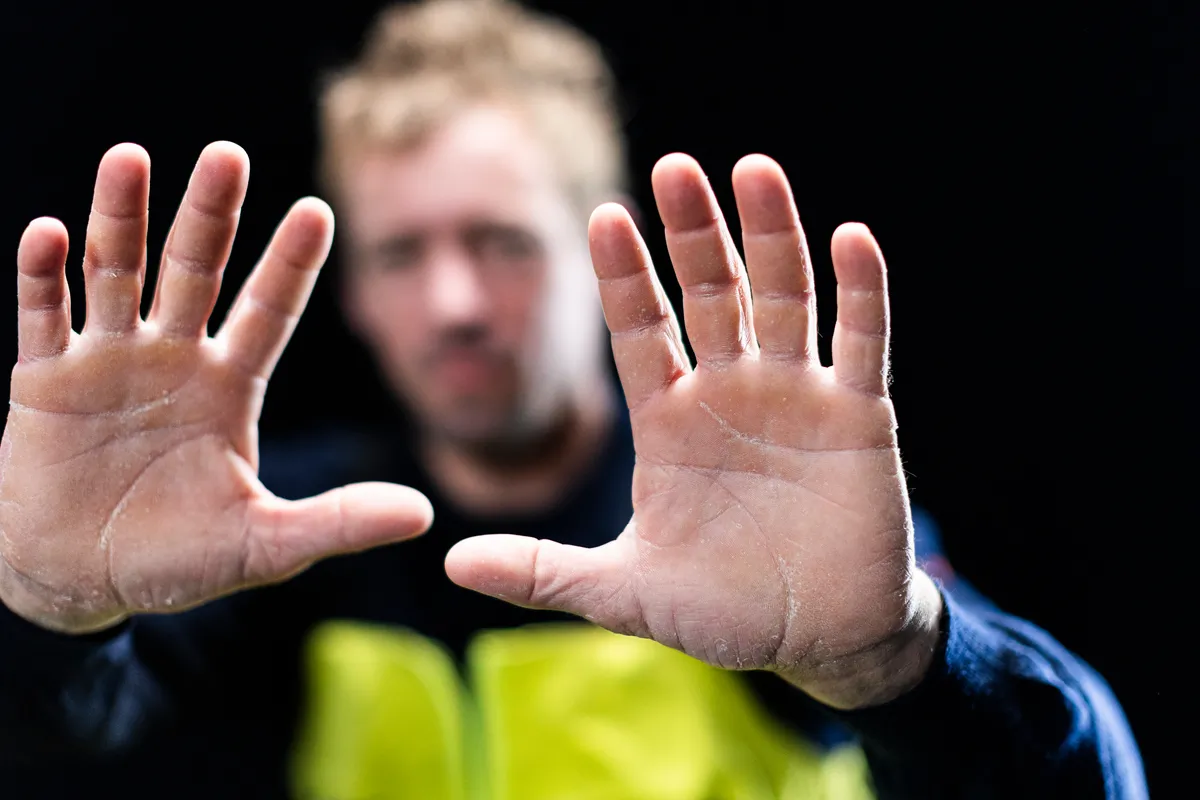 LES SABLES D'OLONNE, FRANCE - JANUARY 25, 2025 : VULNERABLE skipper Thomas Ruyant (FRA) is photographed in studio showing his hands, after taking 7th place in the Vendee Globe, on January 25, 2025 in Les Sables d'Olonne, France - (Photo by Mark Lloyd / Alea)
