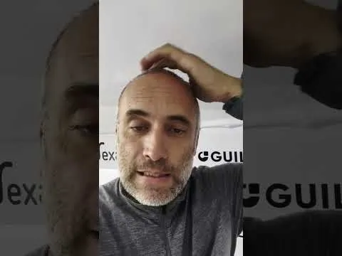 Un chemin de résilience pour Fabrice Amedeo | Vendée Globe 2024